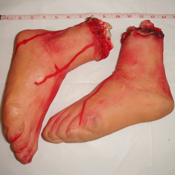 Human Foot
